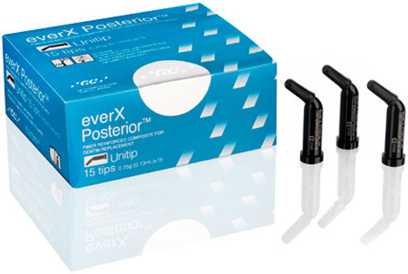 everx posterior unitip 15x0.25 (productfoto)