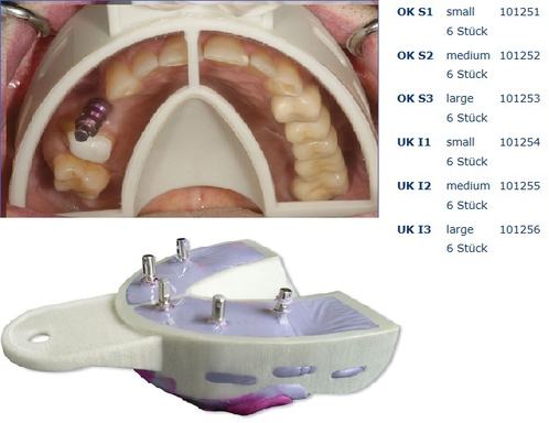 miratray implant boven small s1 6 (productfoto)