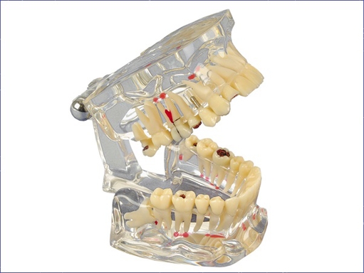 studiemodel transparant deluxe (productfoto)