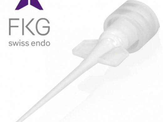 fkg totalfill tips 15 stuks (productfoto)