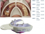 miratray implant boven medium s2 6 (thumbnail)